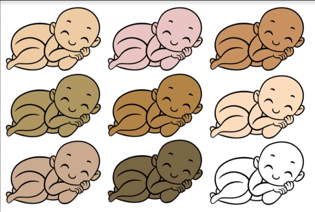 How To Determine Your Baby Skin Color EdieandAmy